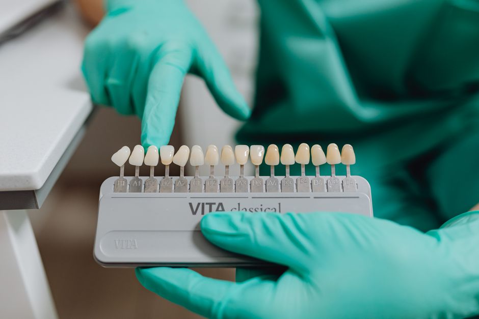 Diferenta dintre coroana dentara si punte dentara explicata simplu