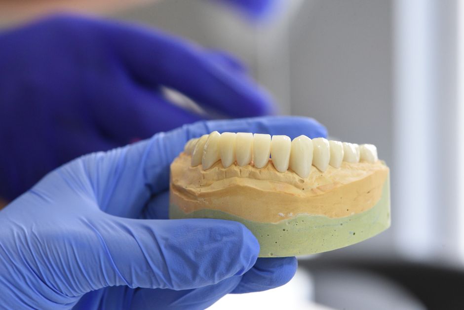 Întrebări importante de pus înainte de implant dentar