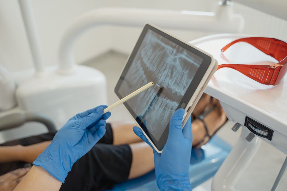 Radiografia dentara: siguranta si necesitatea intr-un tratament eficient